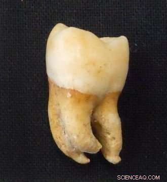 New UC Davis Technique Determines Biological Sex from a Single Tooth, Even 7,300 Years Old