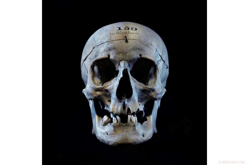 New Forensic Portrait of John Bellingham, the Only Assassin of a British Prime Minister