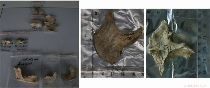 Iron Age Celts in Southern France May Have Embalmed Severed Heads, New Skull Fragment Study Shows