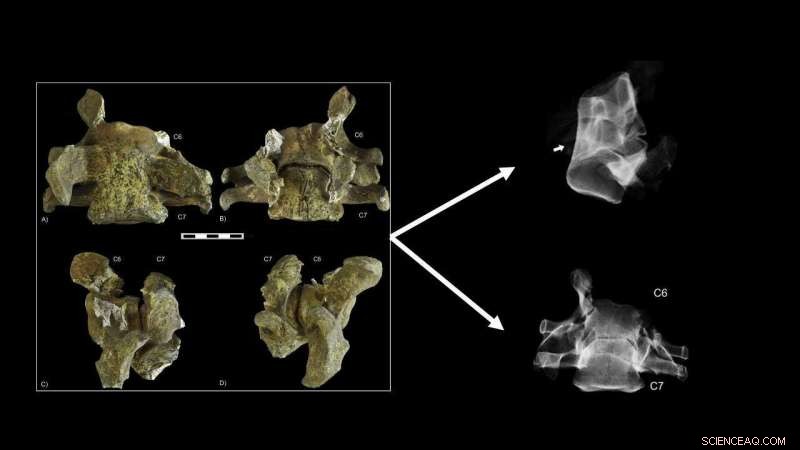 New Study Reveals First Congenital Vertebral Condition in Cave Bears