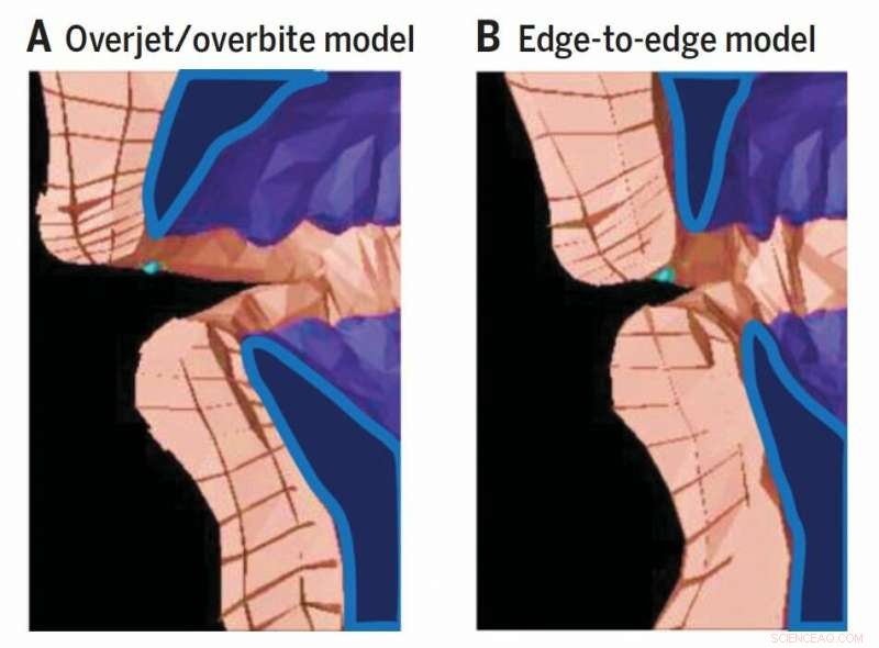 Dietary Changes Spark Innovation in Human Speech Sounds