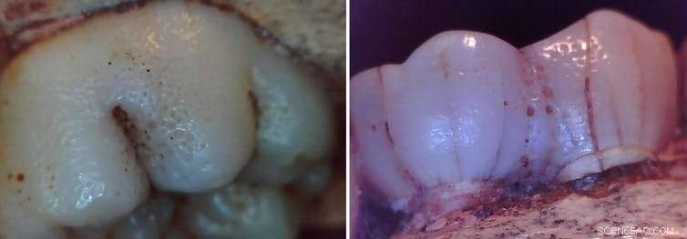 Uncovering the Earliest Common Genetic Disorder in Human Evolution