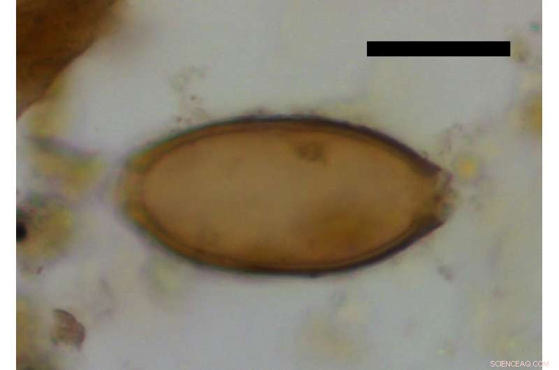 8,000-Year-Old Çatalhöyük Feces Reveal Earliest Intestinal Parasite Record