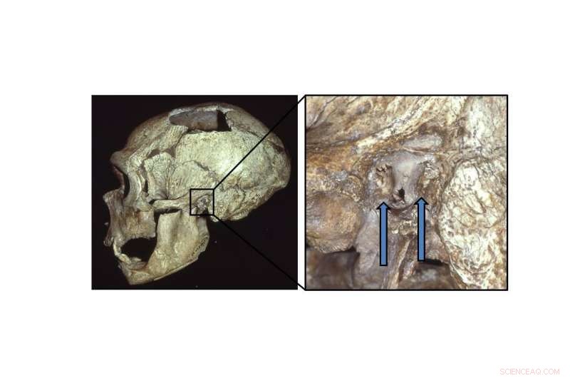 Neanderthal Skull Reveals Swimmer’s Ear, Hinting at Aquatic Activities