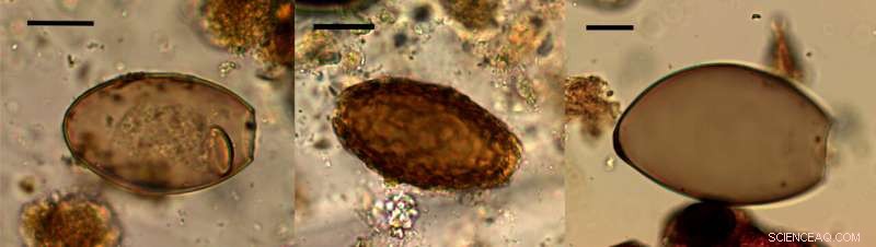 Ancient Feces Uncover Parasite Infections Among Bronze Age Fen Settlers