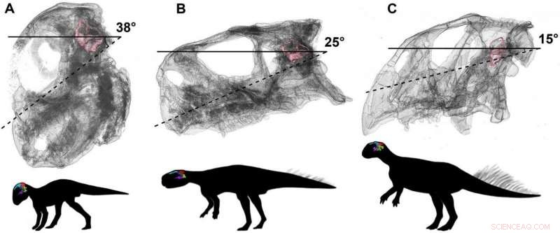 From Hatchling to Adulthood: Tracing Psittacosaurus Brain Development