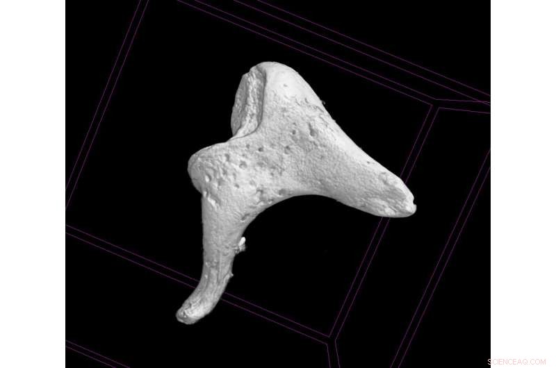 Ear Ossicles Reveal Health Secrets of 18th-19th Century Children