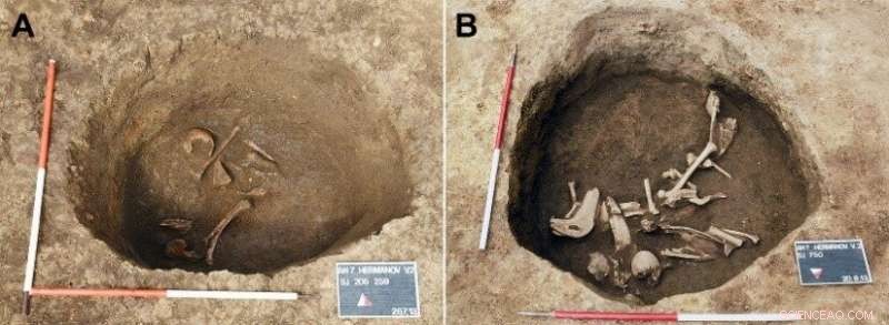 First Evidence of Ancient Cranial Deformation in Croatia (5th‑6th Century)