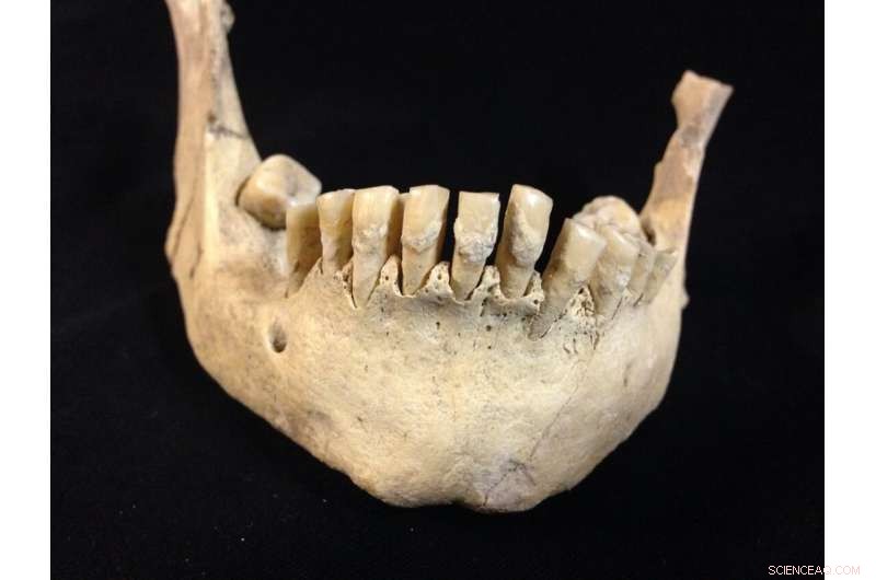 New Study Reveals Earliest Proof of Milk Consumption in Prehistoric Britain