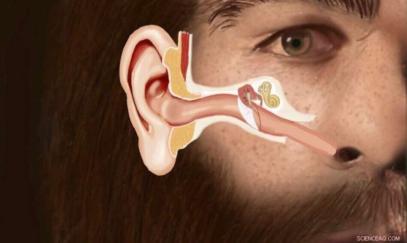 Was a Childhood Illness the Key to the Neanderthals  Demise?