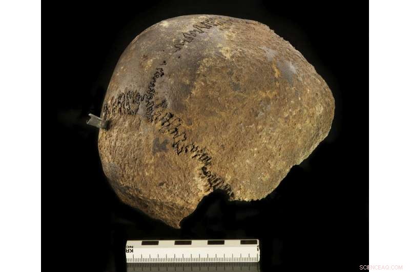 Bronze Age Battlefield Finds: Warrior Pouch Unearthed in Tollense River