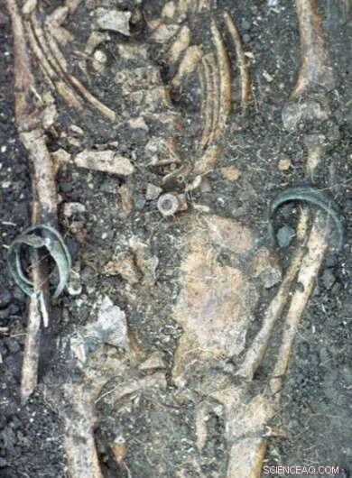 Isotope Analysis Reveals Lead Poisoning Sources in Barbados Slave Remains