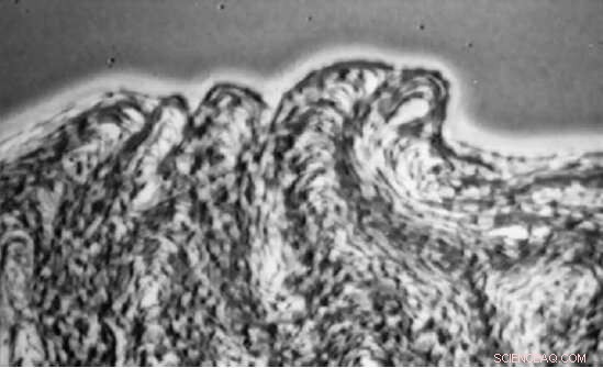 Mathematician Unveils New Method to Simplify Polymer Growth Modeling