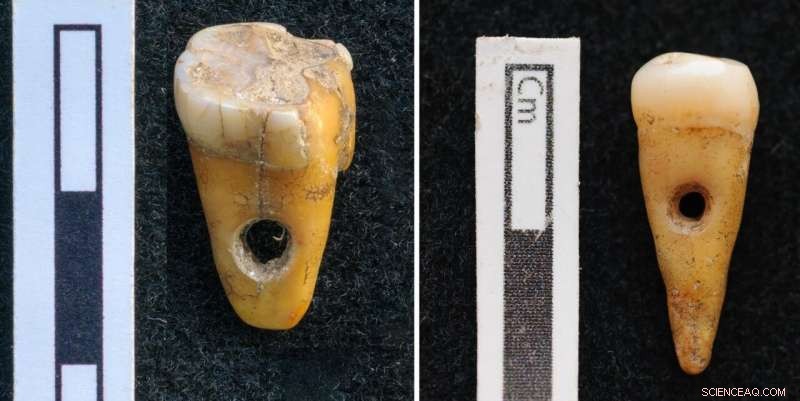 Unveiling Ancient Elegance: 8,500-Year-Old Human Teeth Found as Jewelry in Turkey