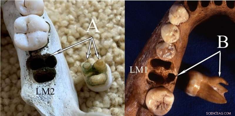 New PNAS Study Challenges Claims of Dental Similarities Between Denisovans and Modern Asians
