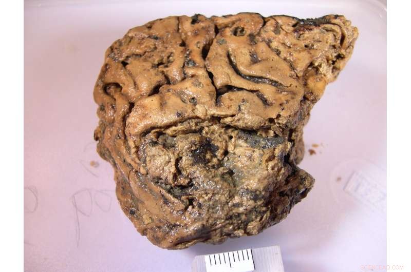 Scientists Reveal How a 2,600-Year-Old Brain Survived to the Present Day