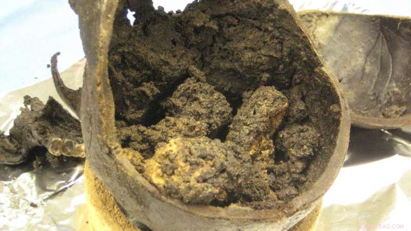 Scientists Reveal How a 2,600-Year-Old Brain Survived to the Present Day