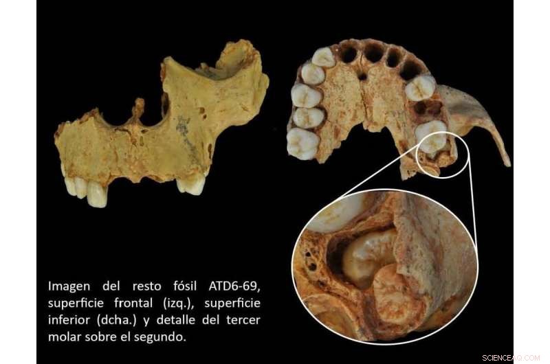 Homo antecessor s Jaw Size Likely Restricted Wisdom Tooth Development