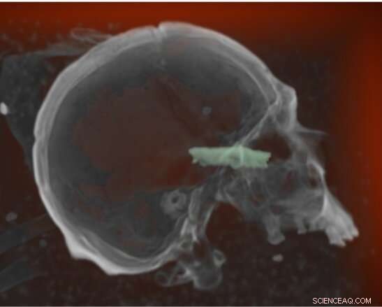 Advanced X‑ray Imaging Unlocks Secrets of Peruvian Mummies