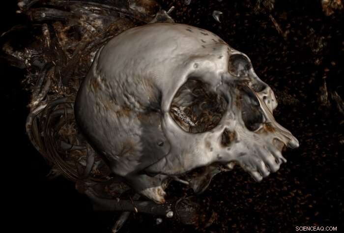 Advanced X‑ray Imaging Unlocks Secrets of Peruvian Mummies