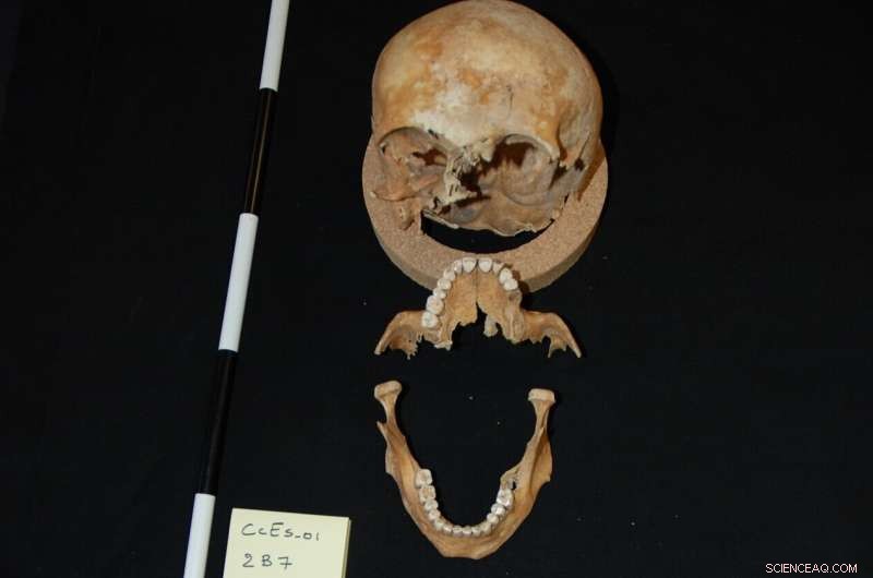 Uncovering Unidentified Victims: Genetics and Genealogy Reveal Those in Unmarked Graves