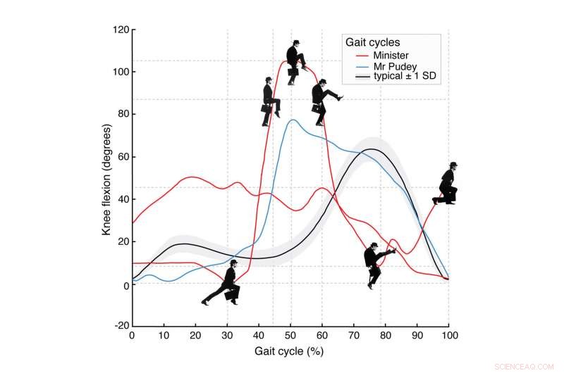 Monty Python s  Silly Walk  as a Case Study: Gait Analysis Highlights Peer Review Inefficiencies