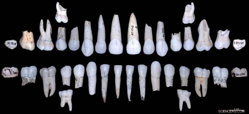 Atapuerca Hominids Show Faster Tooth Enamel Growth Than Modern Humans