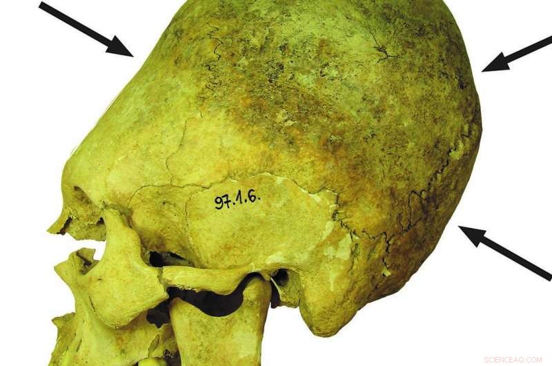 Ancient Mözs-Icsei Skulls Uncover a Multicultural Community in Transition