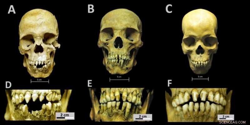 Early Colonial Mexico: African Skeletons Illuminate First-Generation Slave Narratives