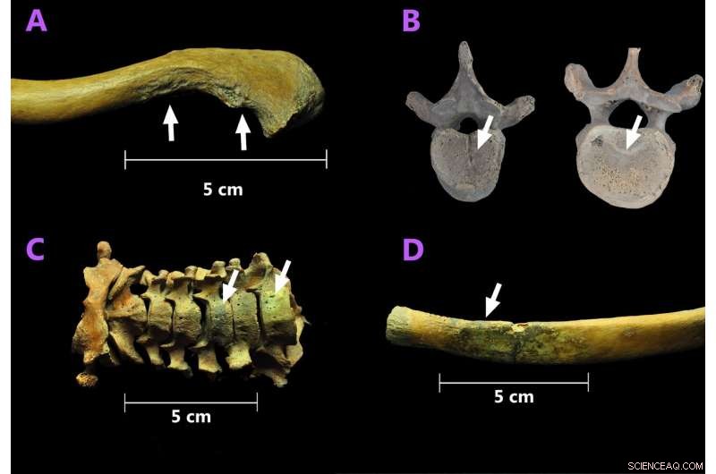 Early Colonial Mexico: African Skeletons Illuminate First-Generation Slave Narratives