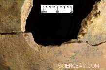 New Study Shows Medieval Arrow Injuries Mirror Modern Gunshot Wounds