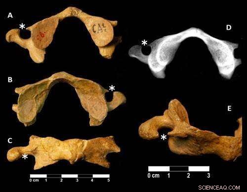 New Research Links Neanderthal Genetic Diversity Decline to Their Extinction