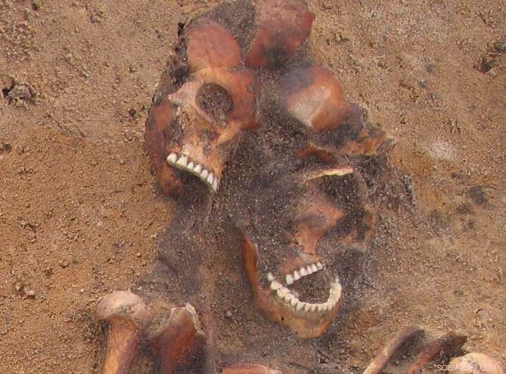 New Findings Reframe the History of a Syphilis-Related Pathogen in Medieval Europe