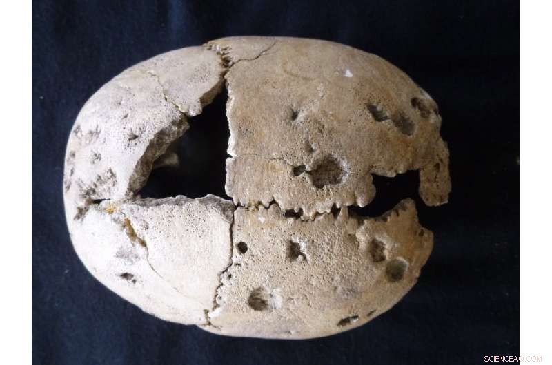 Archaeology Uncovers the History of Epidemics and Human Resilience