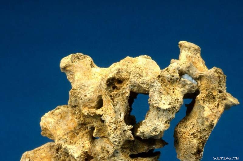 Archaeology Uncovers the History of Epidemics and Human Resilience