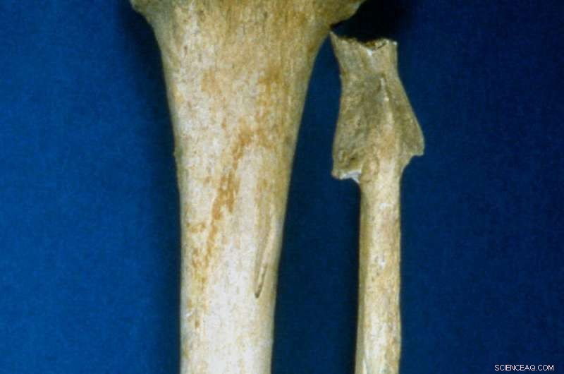 Archaeology Uncovers the History of Epidemics and Human Resilience