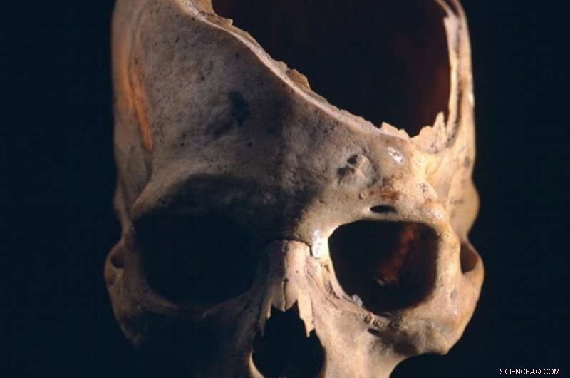 Archaeology Uncovers the History of Epidemics and Human Resilience