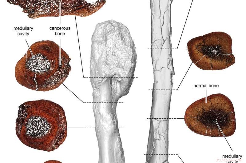 Groundbreaking Study Detects Malignant Cancer in Dinosaur for First Time