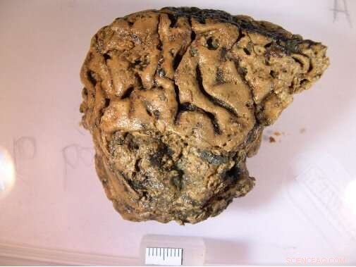 York s History Unearthed: From Neolithic Roots to Modern Times in Groundbreaking University Dig