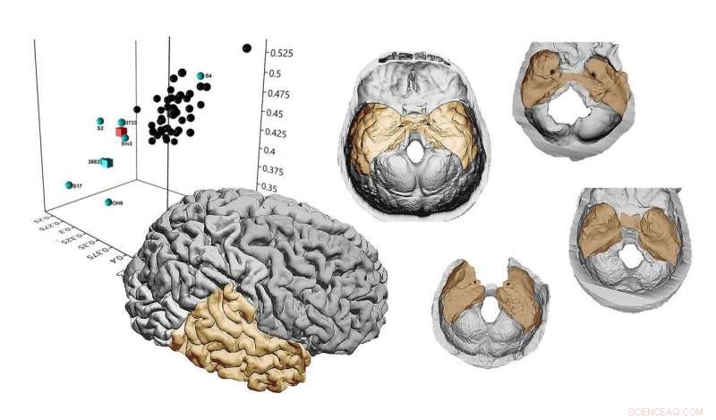 New Study Shows Homo erectus Temporal Lobes Were Smaller Than Those of Modern Humans