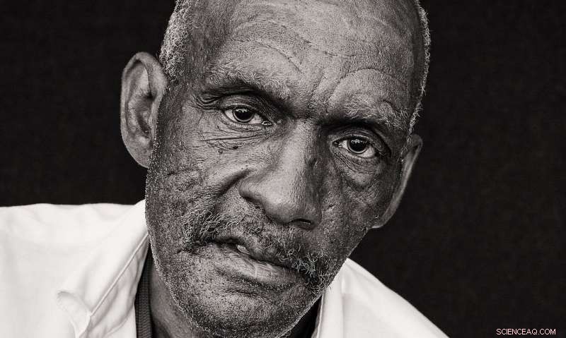 Racial Bias Exacerbated in Police Kills of Older, Mentally Ill, Unarmed Men