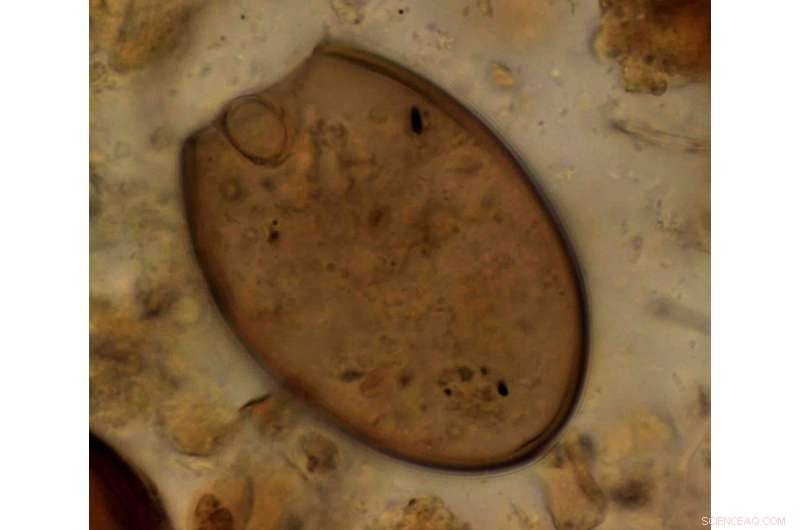 Ancient DNA from Medieval Latrines Reveals Gut Health Across Europe and the Middle East