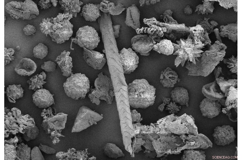 Ancient Mummy s Gut Reveals Early Signs of Hospice Care