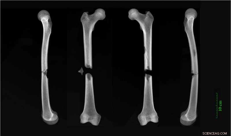 New Study Reveals Social Inequality in Medieval Cambridge Through Human Bones