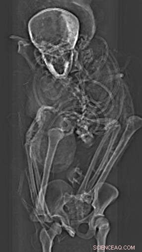 CT Scans of Egyptian Mummy Unveil New Details on the Death of a Pivotal Pharaoh