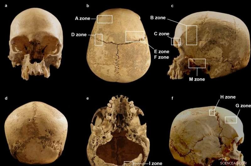 The Curious Journey of a Human Skull: How One Cranium Ended Up Alone in an Italian Cave