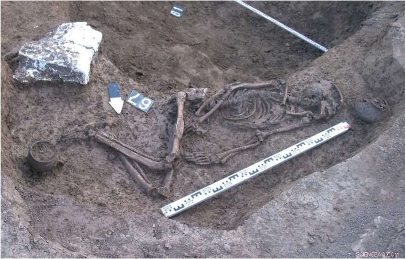 Bronze Age Rare Diseases: Uncovering Insights from the North Caucasus
