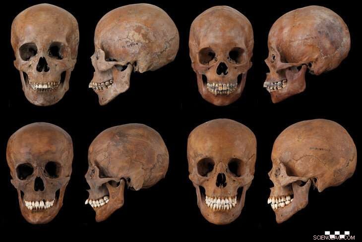 Ancient Oral Microbiome Reveals Links to Overall Health