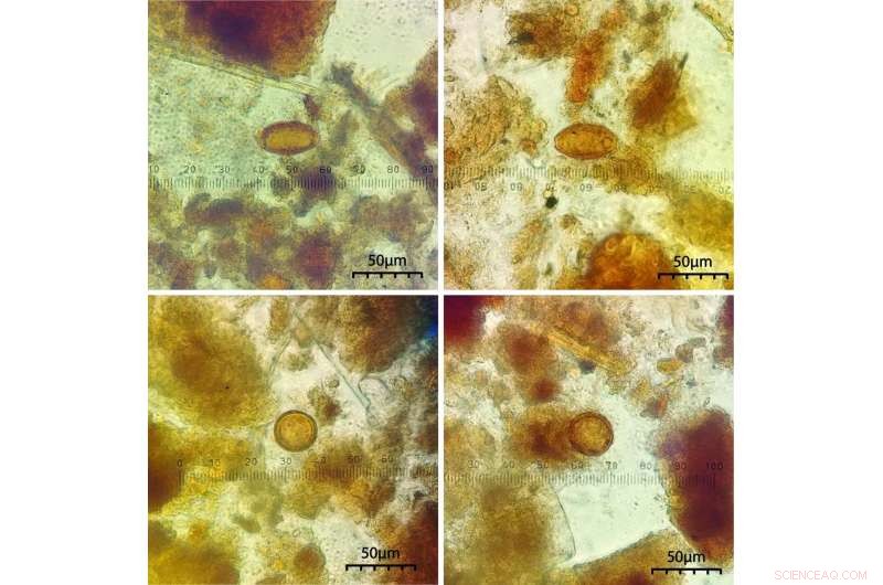 Archaeological Evidence Reveals Parasitic Infections Among 19th-Century New England Elites