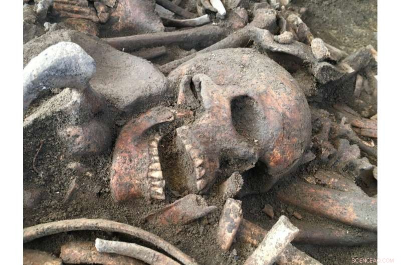 Innovative Near‑Non‑Destructive Method for Extracting DNA from Human Remains